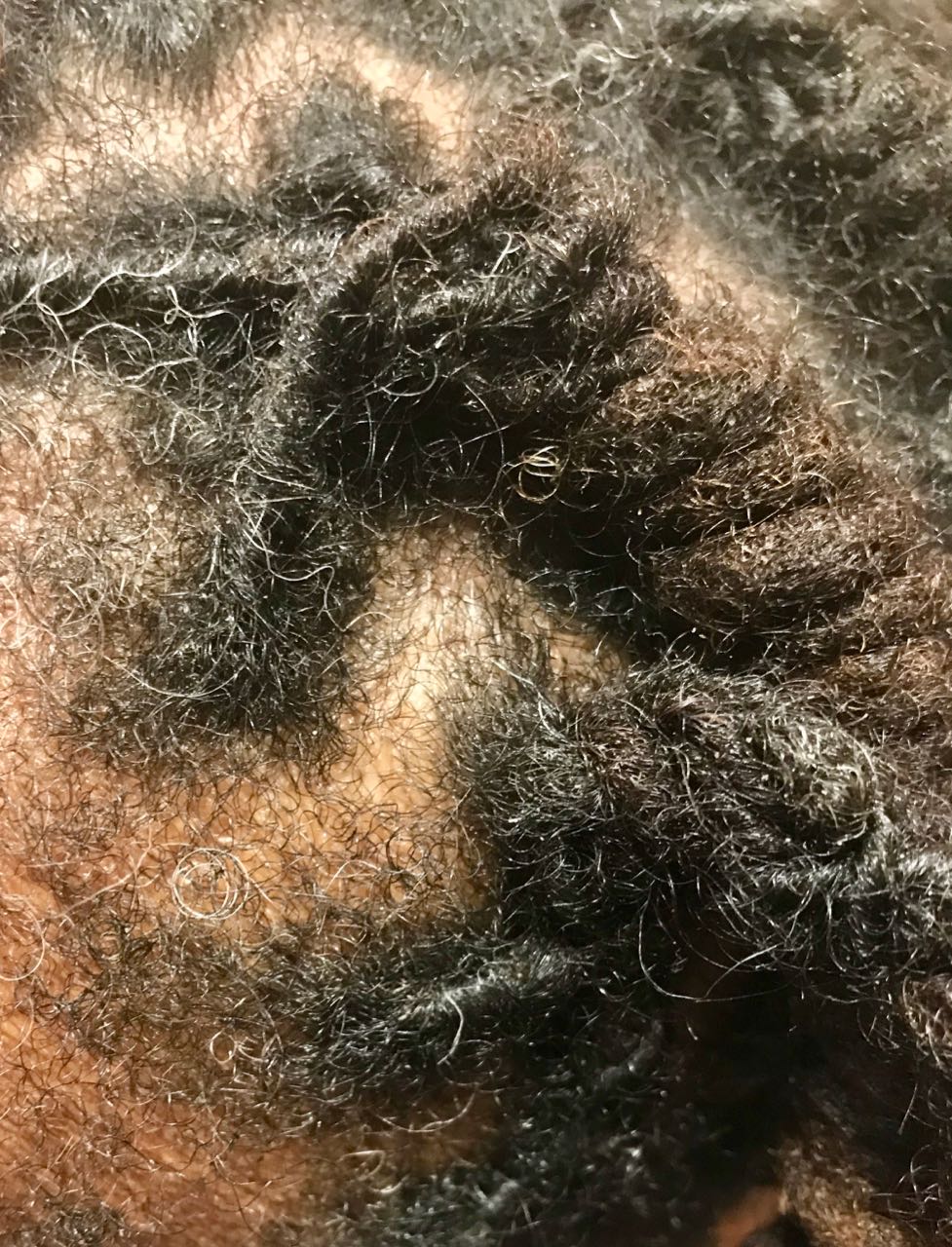 afro scalp cleansing frontal view