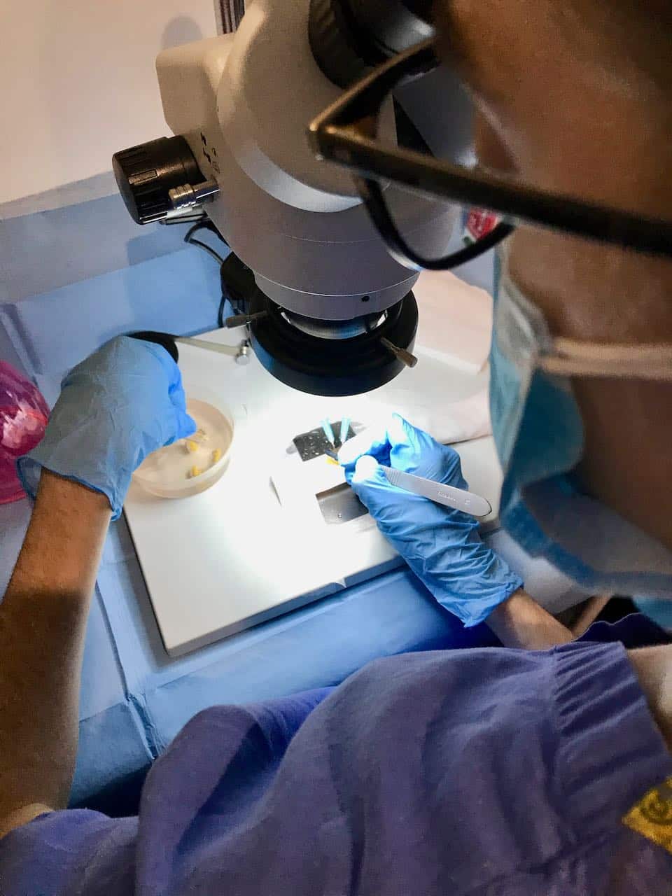 afro hair transplant cutting the strip