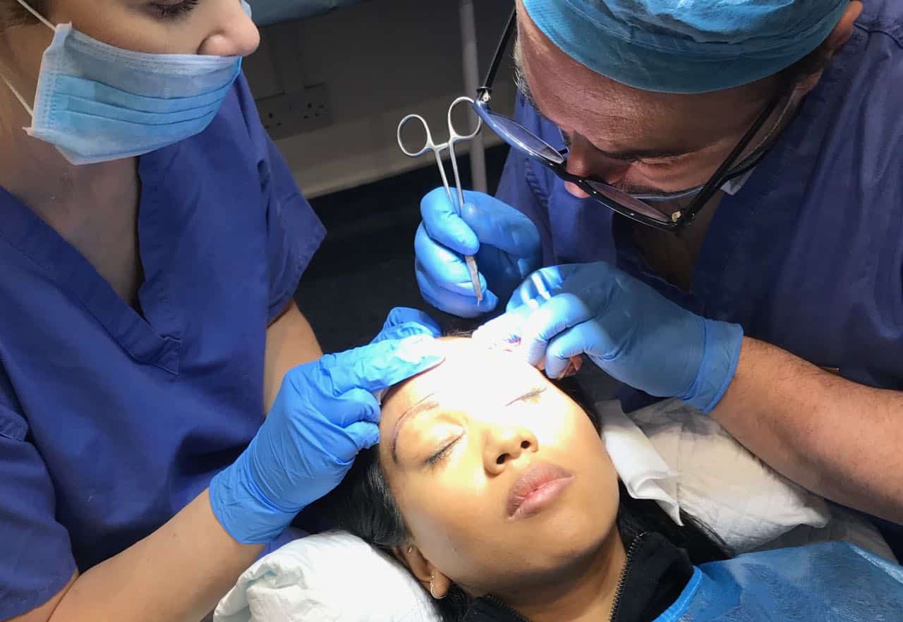 asian eyebrow transplant