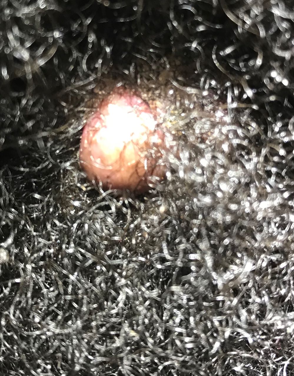 scarring alopecia