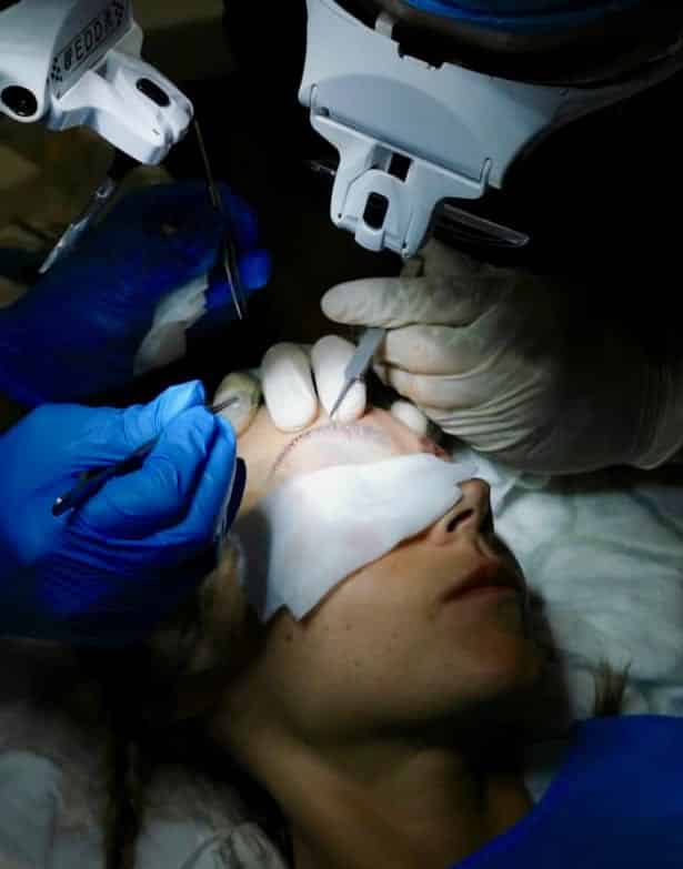 eyebrow surgery inplanting