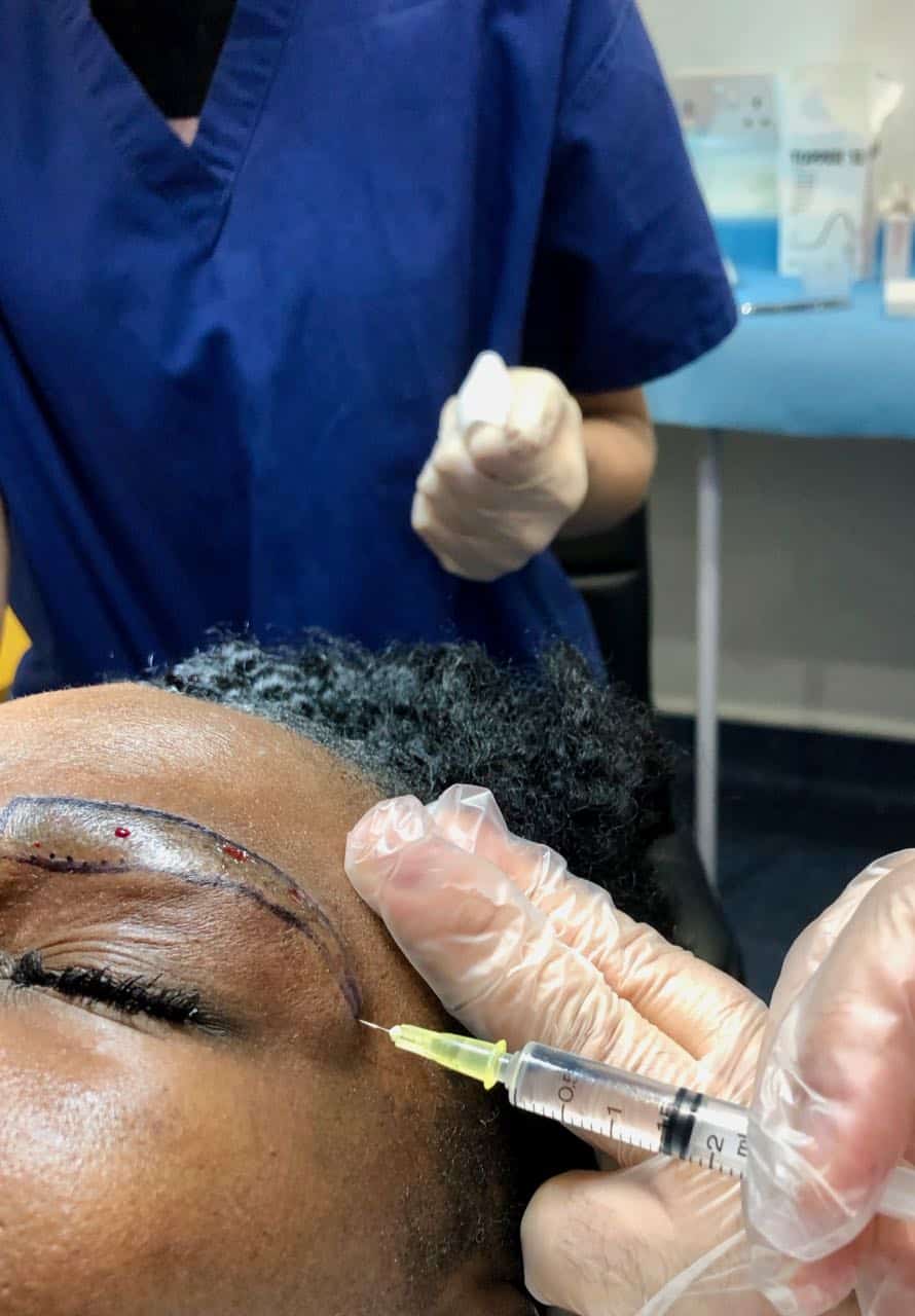 afro eyebrow transplant pain removal