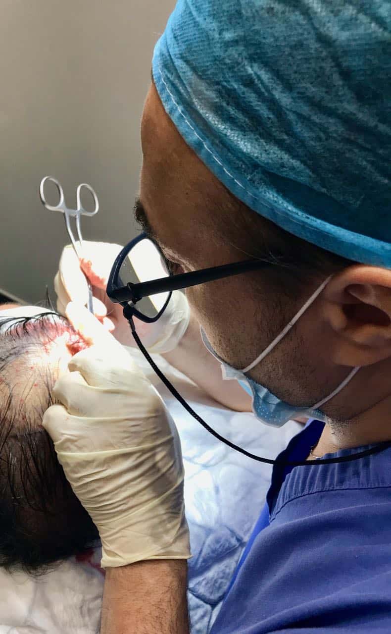 fut hair transplant the incisions