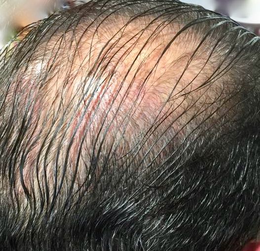 micropigmentation our clinic