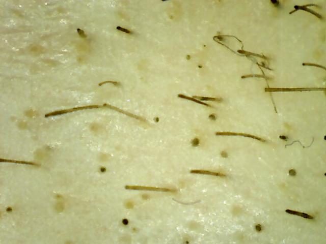 pic0011